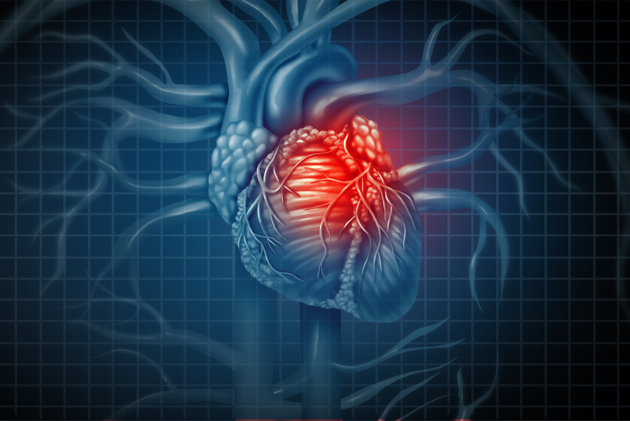 Heart attack pain as a human cardiovascular organ with a painful cardiac inflamation with 3D illustration elements.