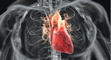 Life After Heart Operation